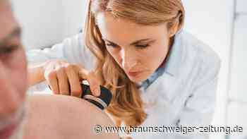 Plötzlich weiße Flecken auf der Haut? Arzt räumt mit Stigma auf