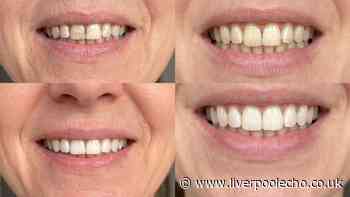 Woman's 'family commented on how great my teeth looked over dinner' after £18 buy