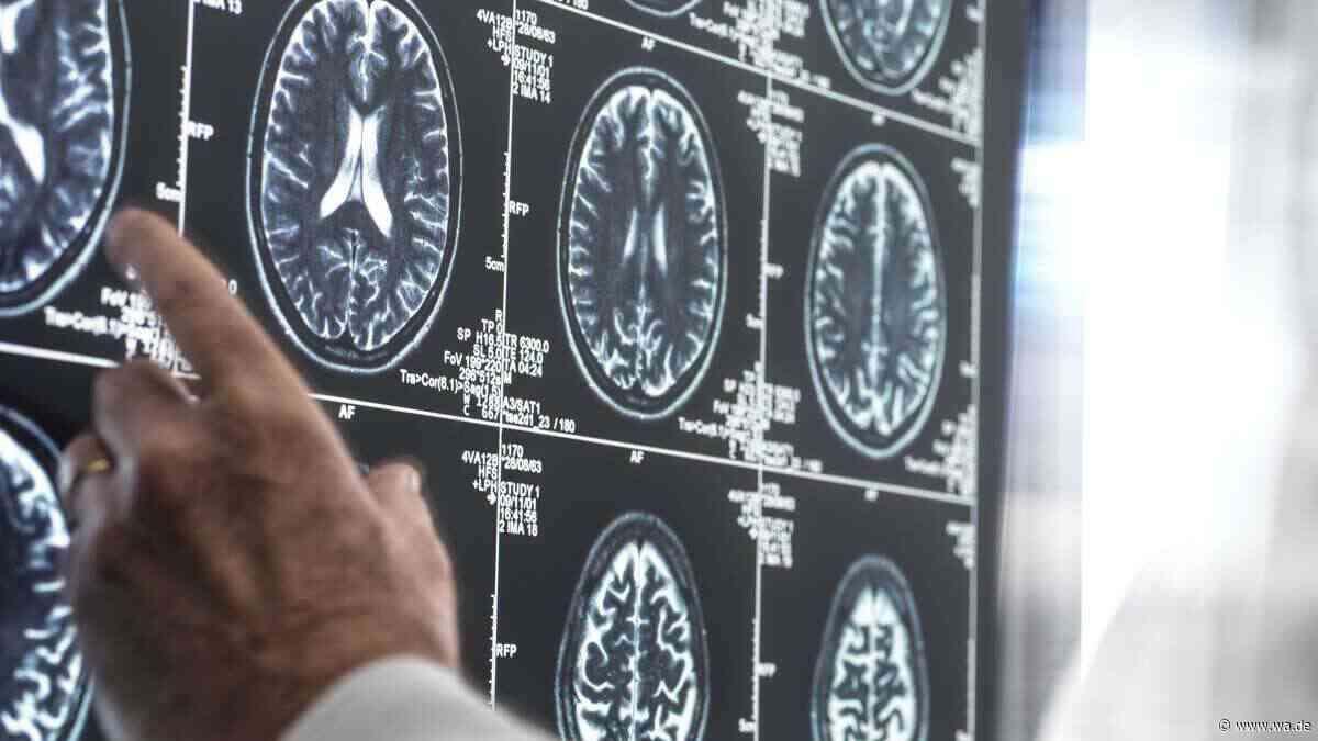 Laut Münchner Radiologie-Facharzt: Warum ein CT-Termin allein noch keine Früherkennung ist