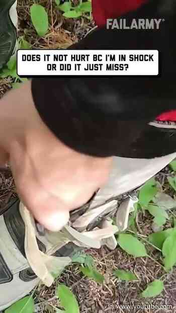 ever seen a branch sticking out of your leg? #bikefail #closecall #dirtbikefails #humor #fail