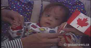 Baby Jose returns to Alberta nearly 30 years after life-saving surgery