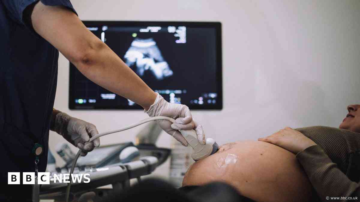 One in five baby deaths 'potentially avoidable' - report