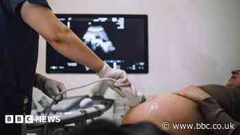 One in five baby deaths 'potentially avoidable' - report
