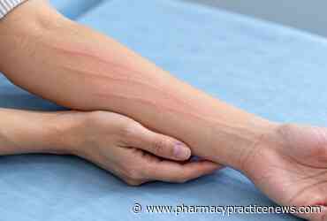 FDA Approves Remibrutinib for Treatment-Resistant Symptomatic Dermographism