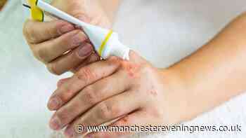 DWP confirms full list of 24 skin conditions that qualify for up to £114 weekly payment