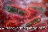 A Diarrhea-Causing Bacterium Spread Through Sex is Resisting Five Common Antibiotics&nbsp;