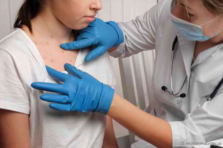 As measles spreads abroad, Lambton Public Health urges up-to-date vaccinations