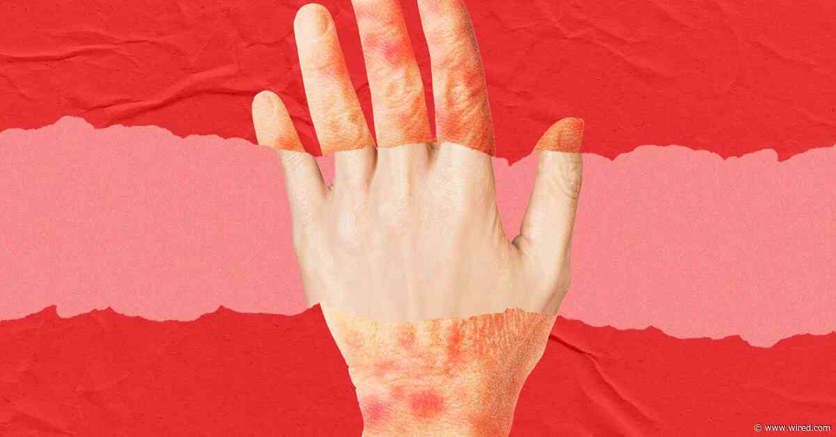 A New Anti-Aging Drug Looks to Turn Back the Clock on Skin Age