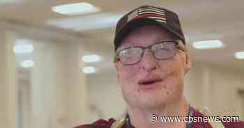 Burn survivor finds a second chance in a Georgia school cafeteria