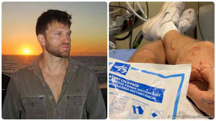“Dio ha detto, ‘no stasera’. La mia vita appesa a un orologio”: Keegan Allen aggredito in strada per rapina
