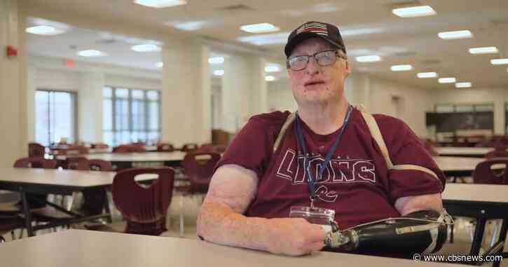 Gas explosion survivor finds hope in Georgia high school cafeteria: "I'm not broken no more"