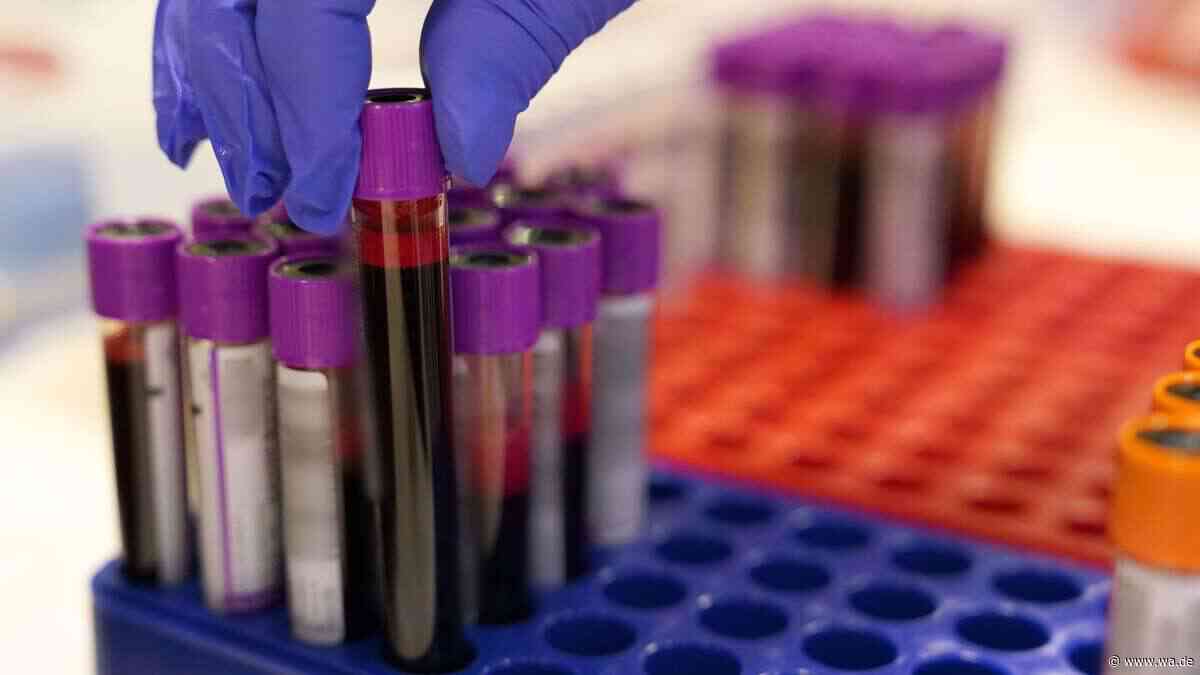 Cholesterin-Durchbruch: Ein Wirkstoff senkt den Wert am stärksten