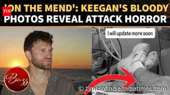 Keegan Allen Shares NEW Photos After Gunpoint Robbery; ‘I’m On The…’