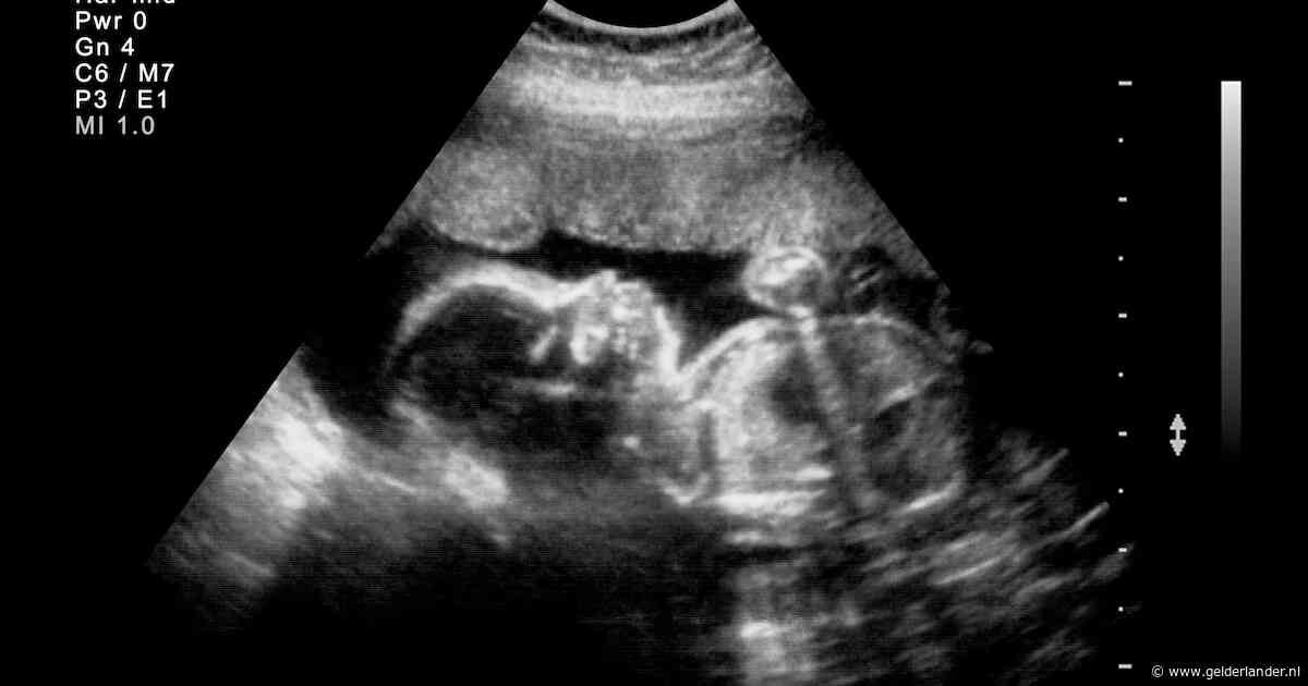 Zwangere vrouwen krijgen vanaf 2027 geen dertienwekenecho meer