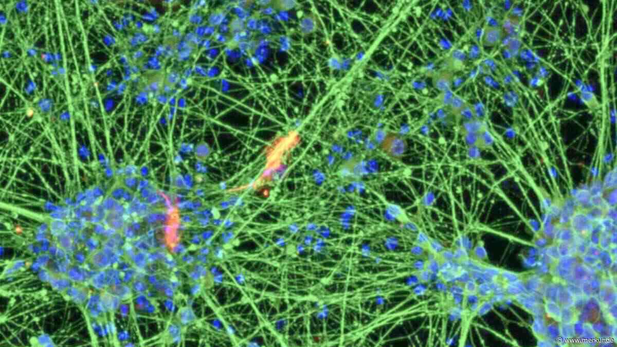Deutsche Forscher verjüngen Zellen eines 80-Jährigen um mehr als 60 Jahre