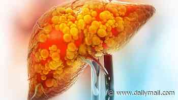 These are the tips I give to all my patients who want to heal their liver disease - with the right changes you can reverse the damage in months: DR PHILIPPA KAYE