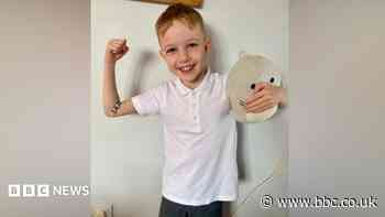 Juvenile arthritis will not stop sports-mad Alfie