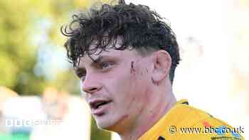 Dragons suffer Woodman bicep injury blow