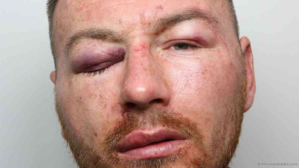 'I'll kill them all' - Thug who took pruning shears to Bradford college 'in bad frame of mind'
