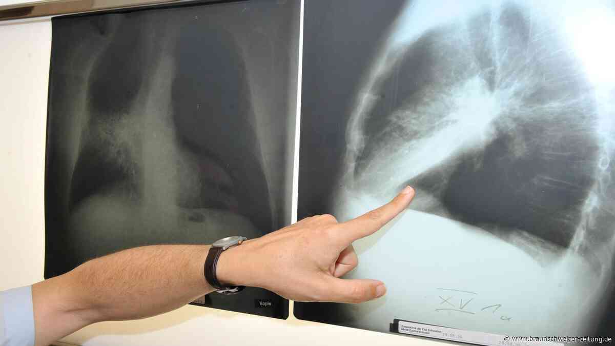 Lungenkrebs-Screening über die Krankenkasse: Experte erklärt, wer es bekommt