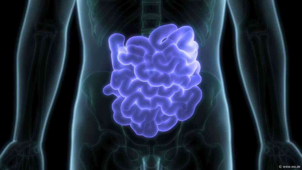 „Leaky Gut“ in den Wechseljahren: Was schon Jahre vorher im Darm passiert