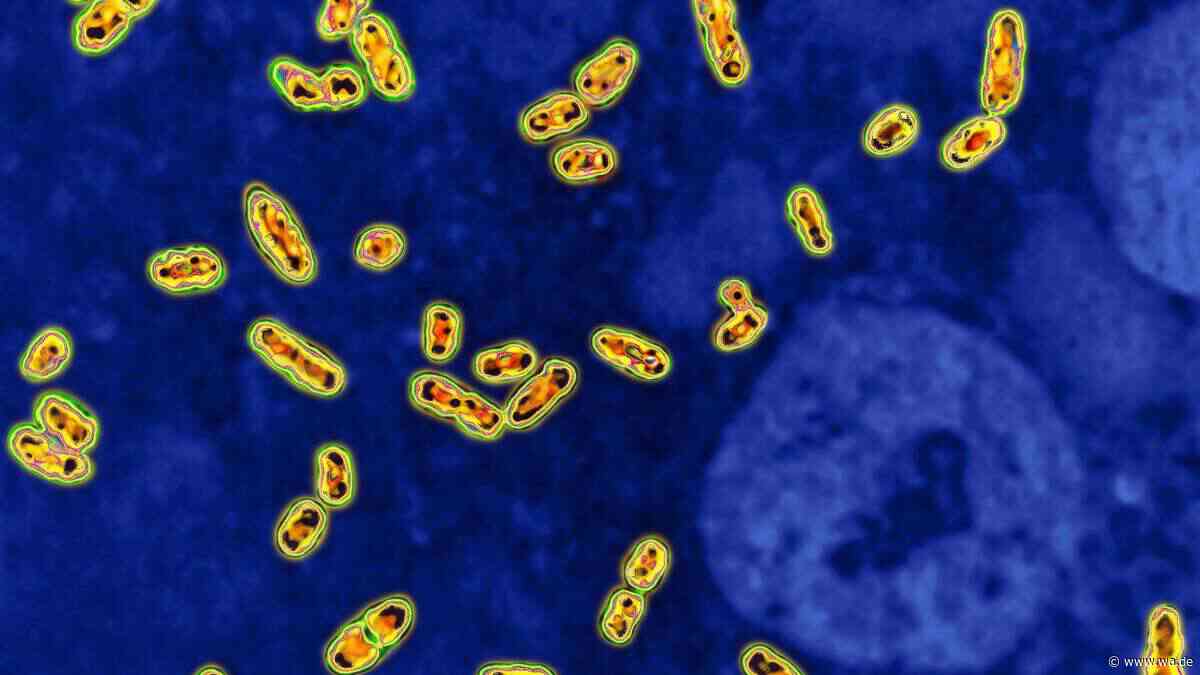Pest-Schock: Neue Studie zeigt tödliche Ausbrüche schon vor 5.500 Jahren