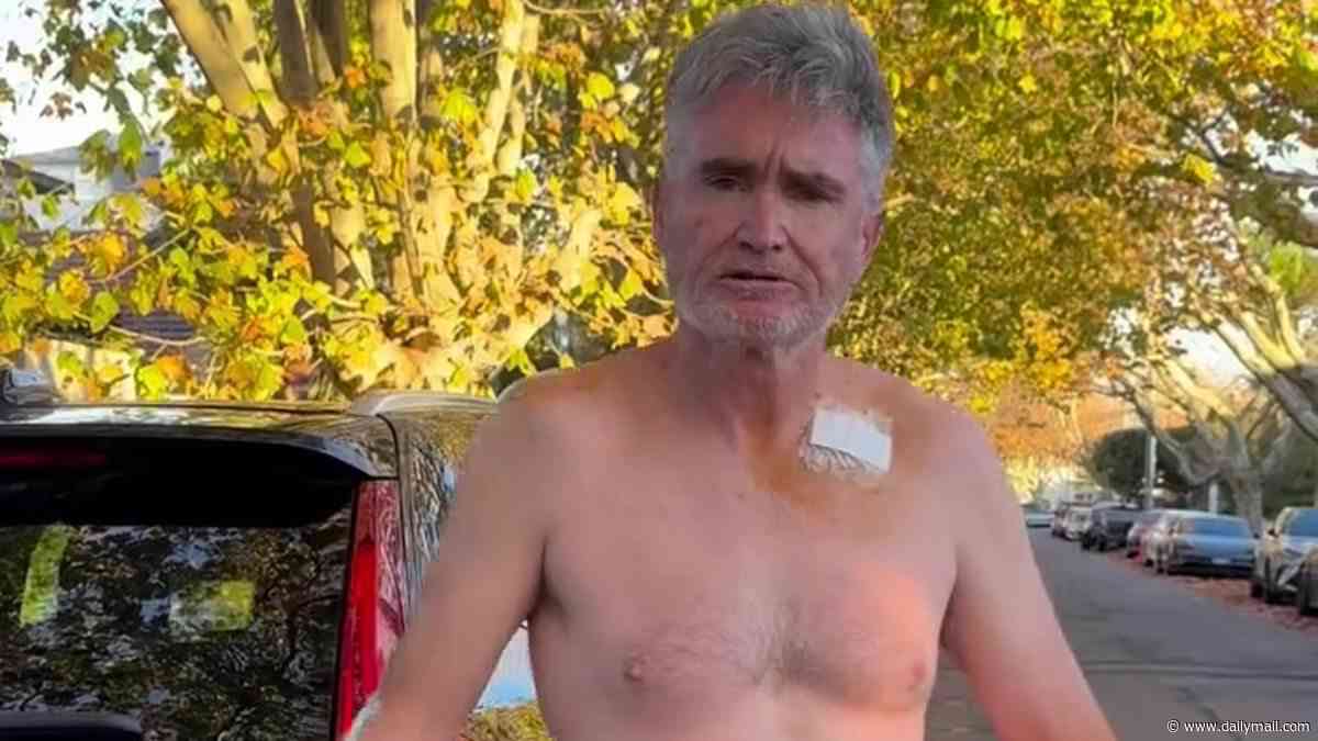 Comedian Dave Hughes tested for 'really bad type of cancer' months after having five lesions removed