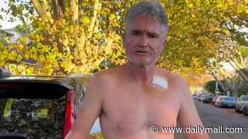 Comedian Dave Hughes tested for 'really bad type of cancer' months after having five lesions removed