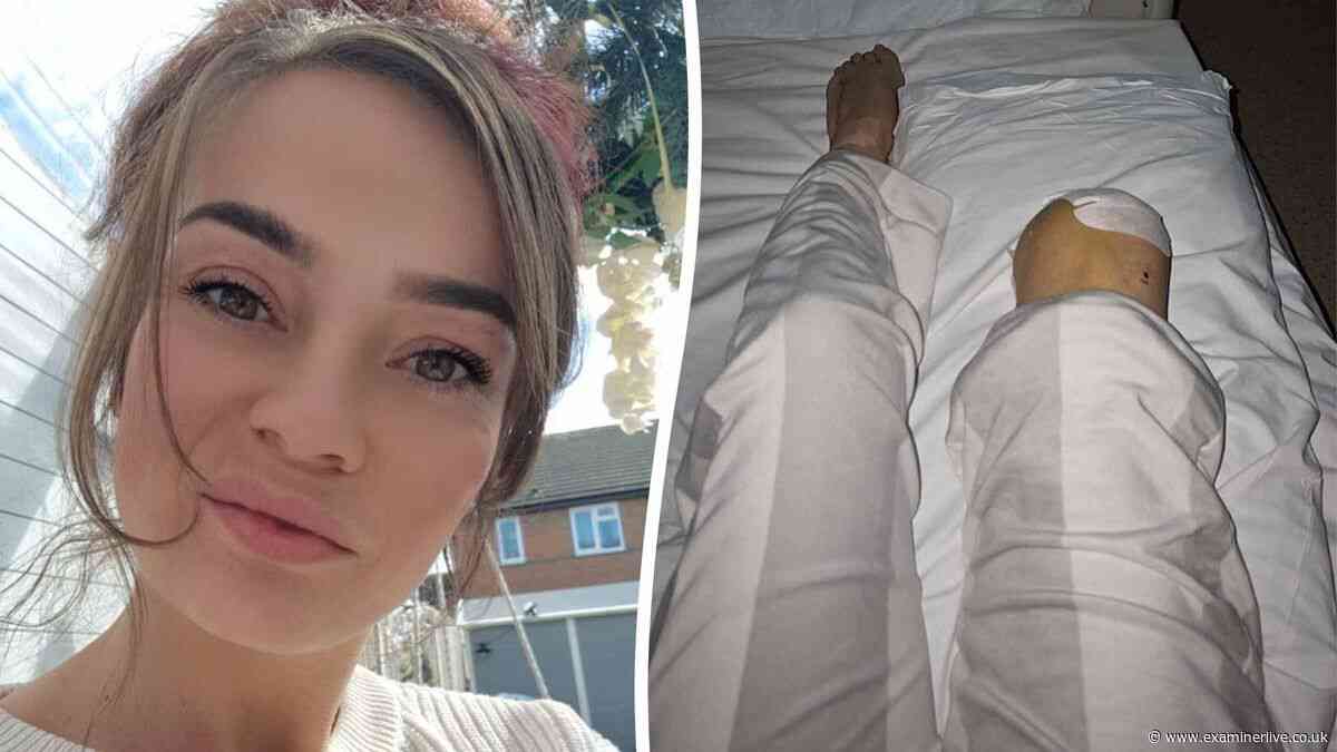 'My world imploded' - Mum told her 'dying' legs were down to anxiety ends up losing one