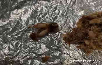 Woman sues Torchy's Tacos over 'cow tooth' in taco