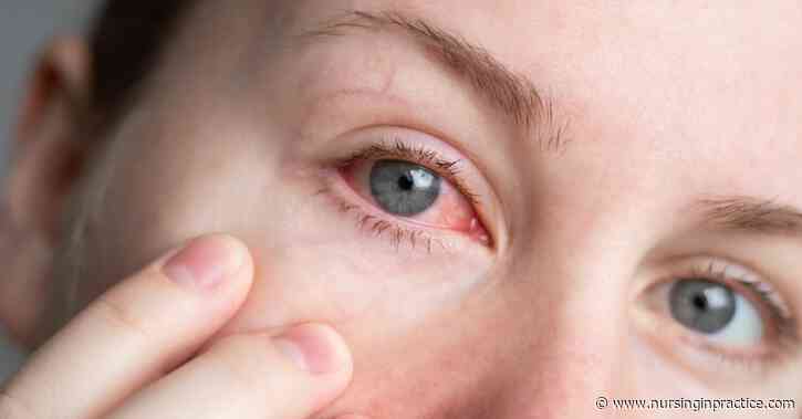 Conjunctivitis: what nurses need to know