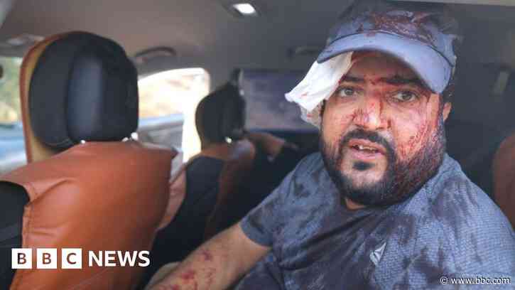 U.S. journalist beaten and Palestinian farmers injured in West Bank settler attack