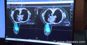New technique uses artificial intelligence to fight breast cancer