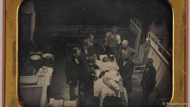 This Famous Ether Daguerreotype Shows the Wrong Patient
