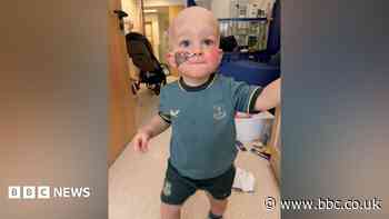 Toddler's 'second chance at life' after stem cell transplant