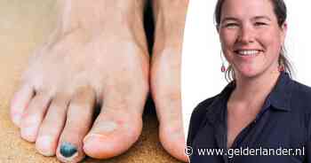 ‘Runners toe’ komt veel voor: zo voorkom je blauwe teennagels na het hardlopen