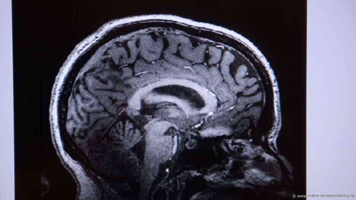 Nach Tod von Adam Wolke: Was ein Hirnaneurysma bedeutet