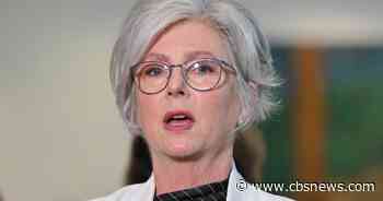 Politician who was intentionally hit by car loses both her legs