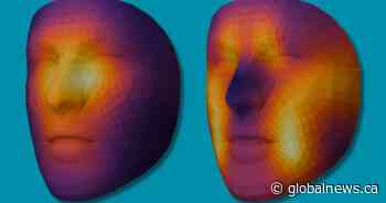 Can a photo help predict if you’ll survive cancer? Researchers think so