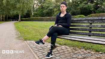 'I thought I just had a cold - but I lost part of my leg to sepsis'