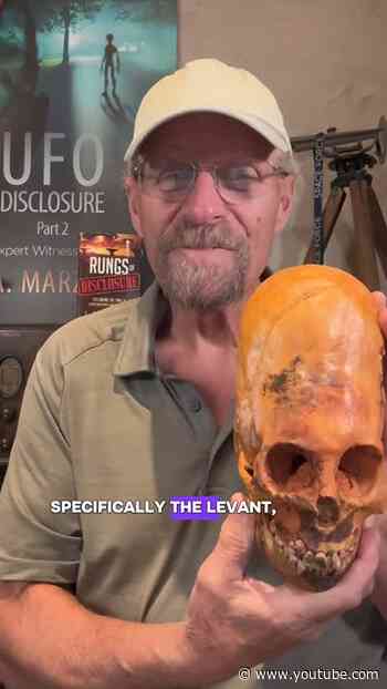 The Paracas SkullS