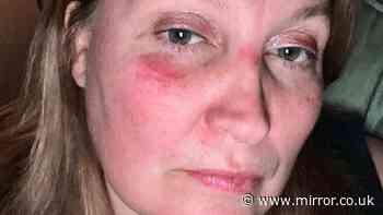 'Acting as a Good Samaritan to save teenager's life has cost me £10,000'