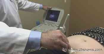 Stress can affect unborn babies' brains, study found