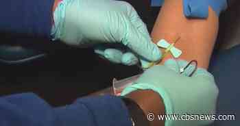 New guidelines aim to identify iron deficiency earlier