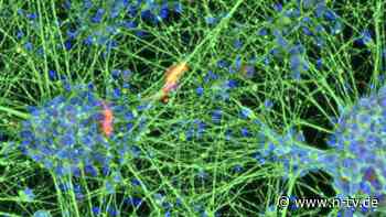 Anti-Aging im Labor: Bonner Forscher lassen alte Zellen wieder jung werden