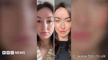 Can you tell ferritin levels from your face?