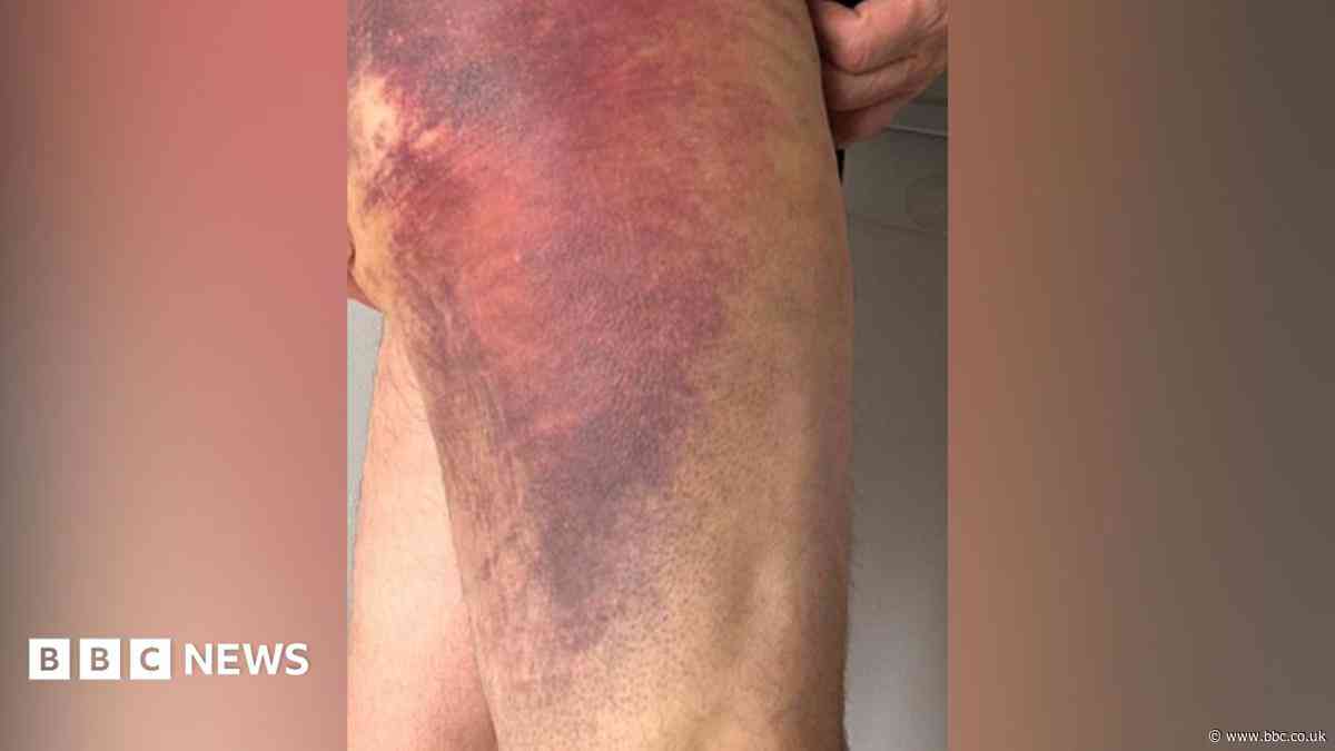 Officer dragged in road during arrest attempt