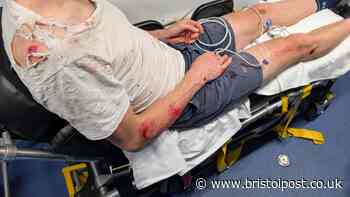 'Bristol is lawless', says cyclist who feared for his life in crash