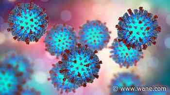 Measles case confirmed in Kosciusko County