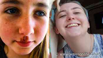 Student who had cold sores every six weeks finds 'miracle' £10 remedy on Amazon